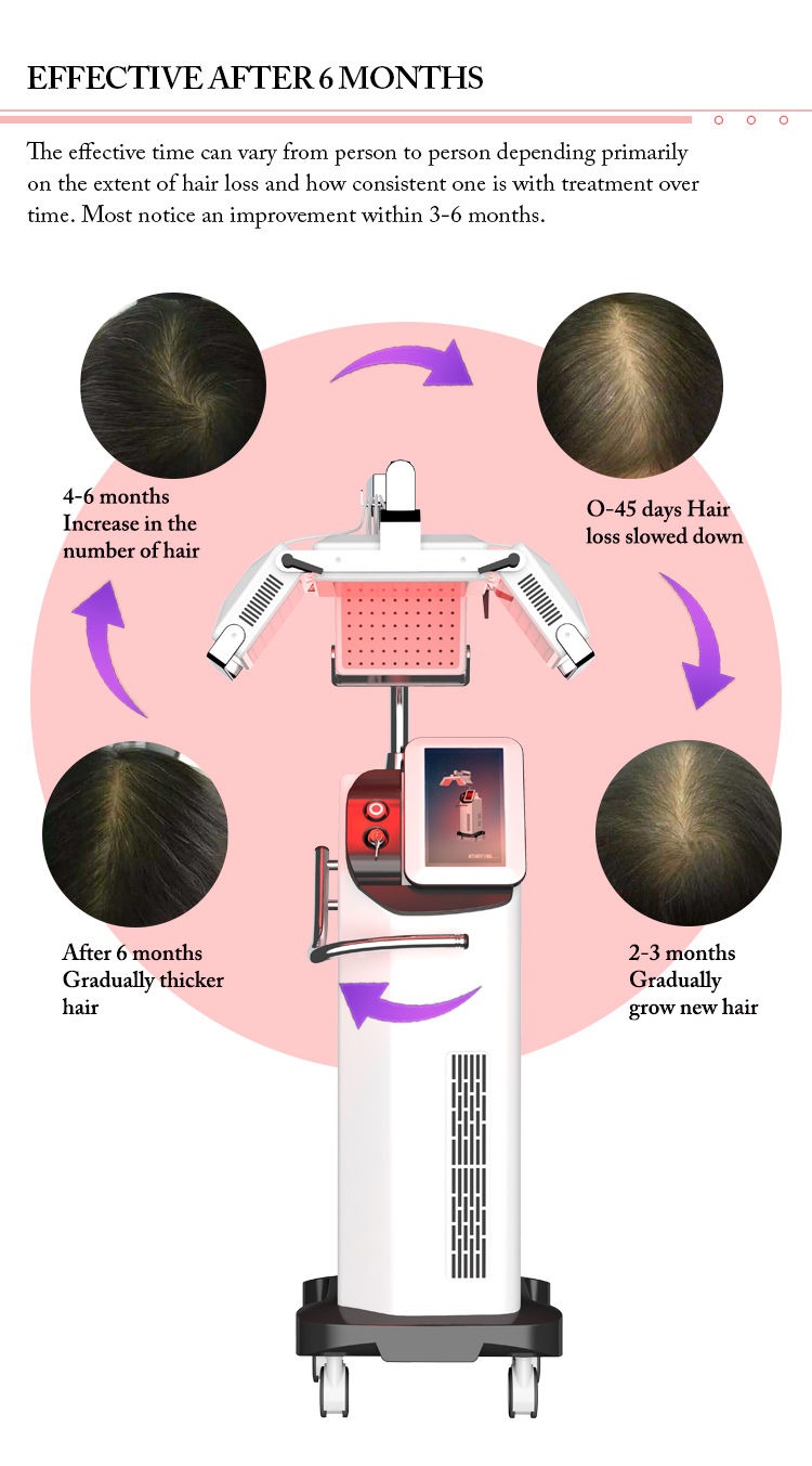effective of laser hair growth machine