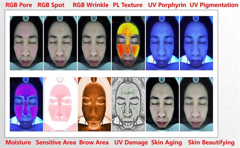 skin analyzer 