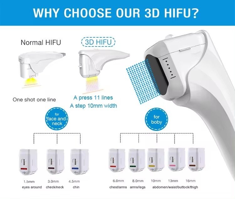 hifu device