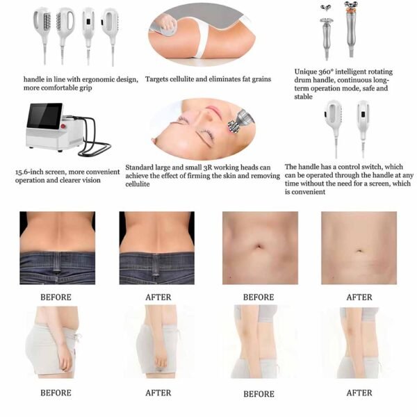 Inner Ball Roller EndoSculpt Face Body Massage Machine