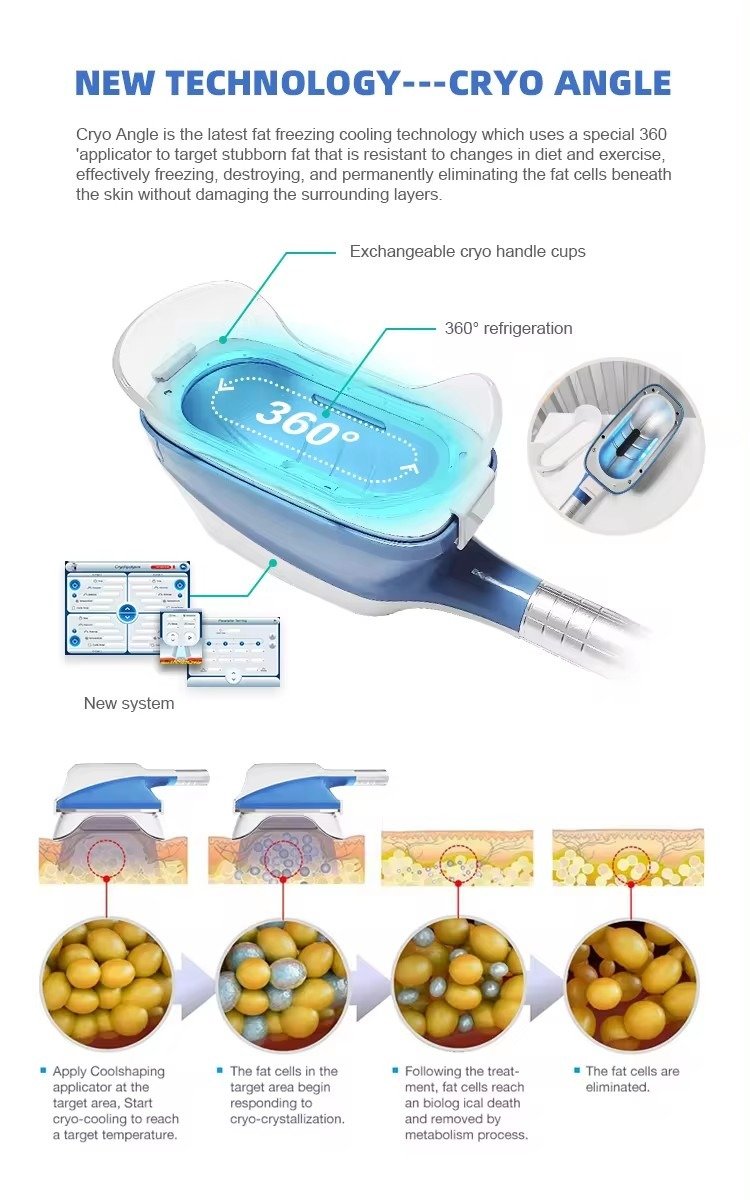 cryotherapy machine