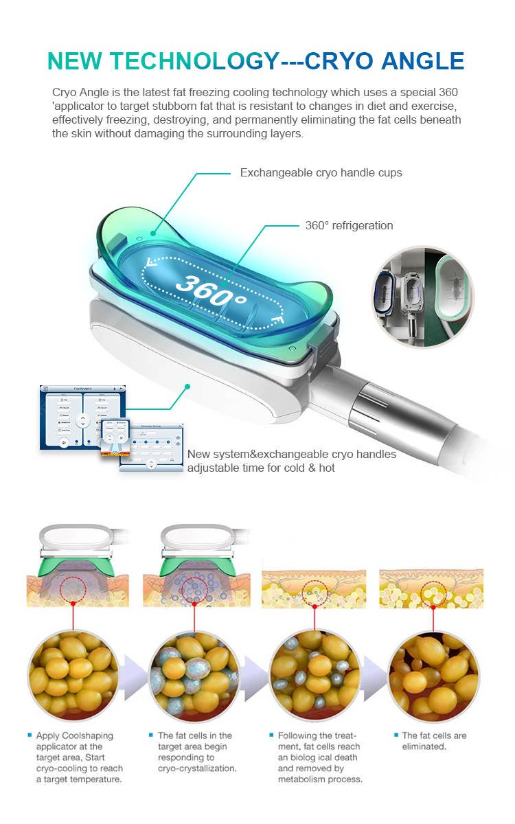 cryo handle