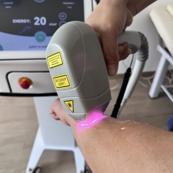 810 nm Diode Laser Portable Permanent Hair Removal Machine