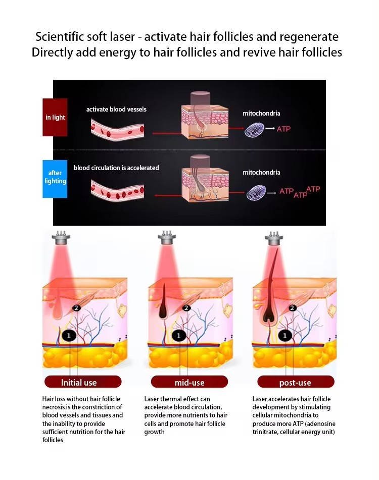 diode laser hair regrowth