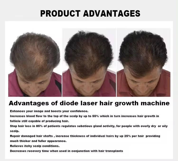 diode laser