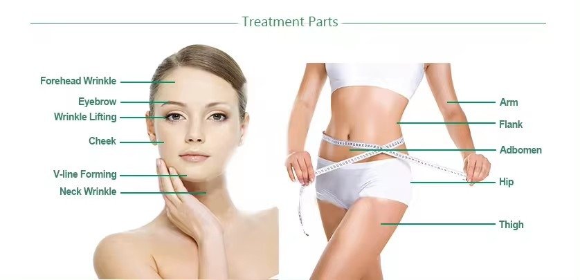 hifu treatment parts