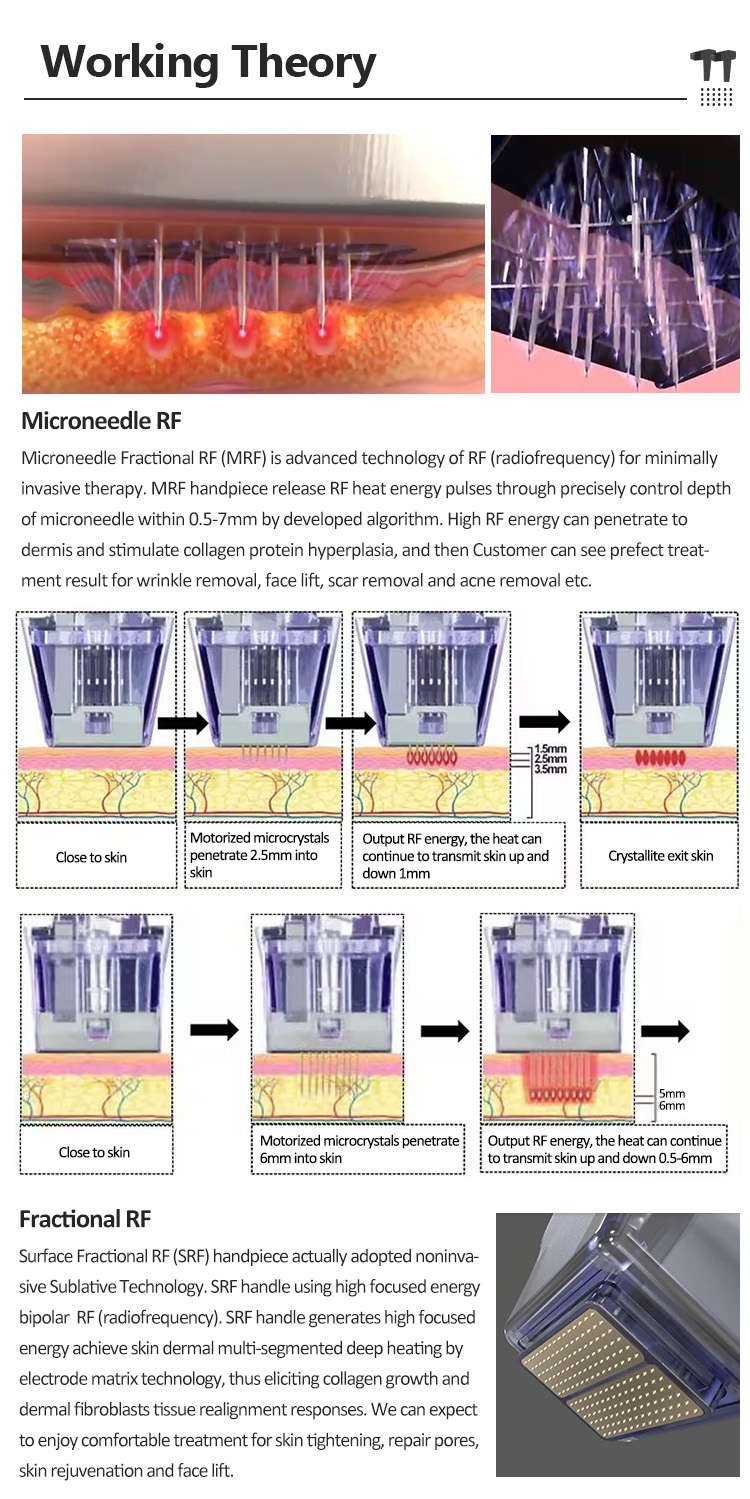 microneedling rf Theory