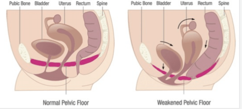 Pelvic Floor